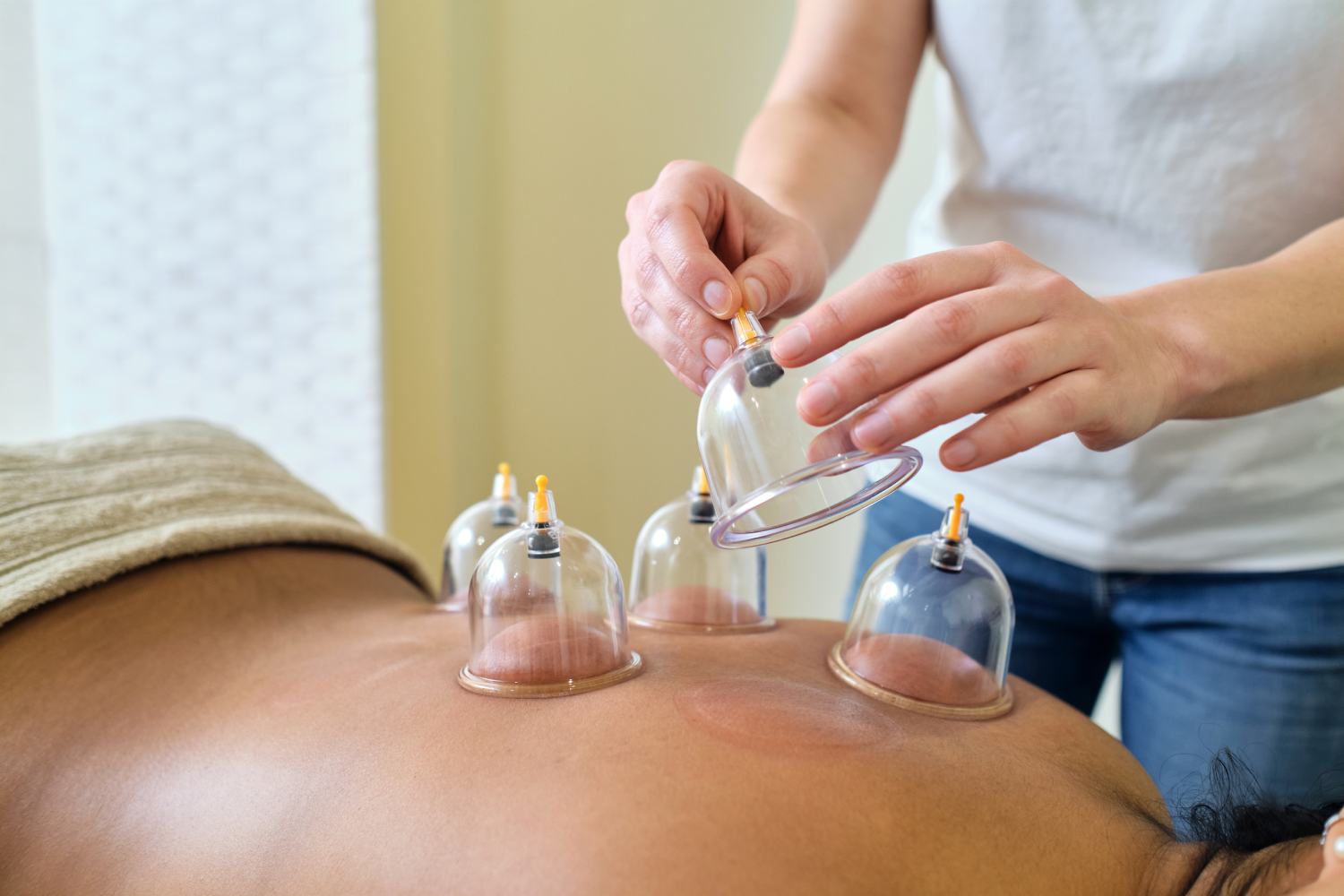 Hacamat (Kupa Terapisi)